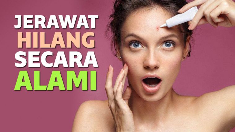 13 Cara Menghilangkan Bekas Jerawat Dengan Bahan Alami 13 Cara Menghilangkan Bekas Jerawat Dengan Bahan Alami