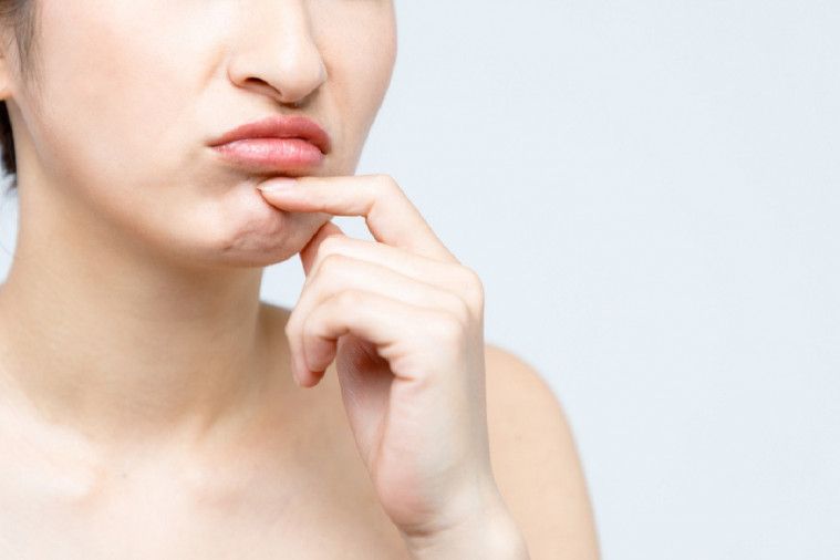 5 Cara Menghilangkan Bruntusan di Dagu Secara Permanen 5 Cara Menghilangkan Bruntusan di Dagu Secara Permanen