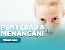 Penyebab Mimisan dan Pertolongan Pertama Mandiri yang Tepat