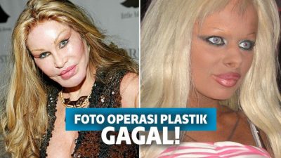 Duh! 15 Hasil Operasi Plastik Gagal Ini Malah Bikin Prihatin Duh! 15 Hasil Operasi Plastik Gagal Ini Malah Bikin Prihatin