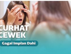 Curhatan Viral Cewek Gagal Implan Dahi