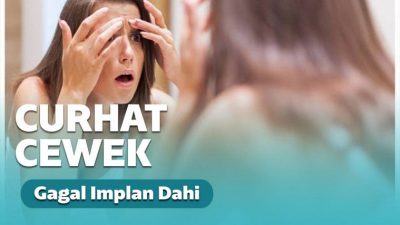 Curhatan Viral Cewek Gagal Implan Dahi Curhatan Viral Cewek Gagal Implan Dahi