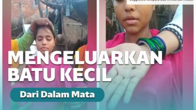 Gadis di India Keluarkan Batu Kecil Saat Menangis